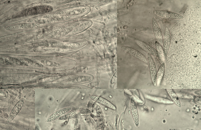 Ascocoryne cylichnium